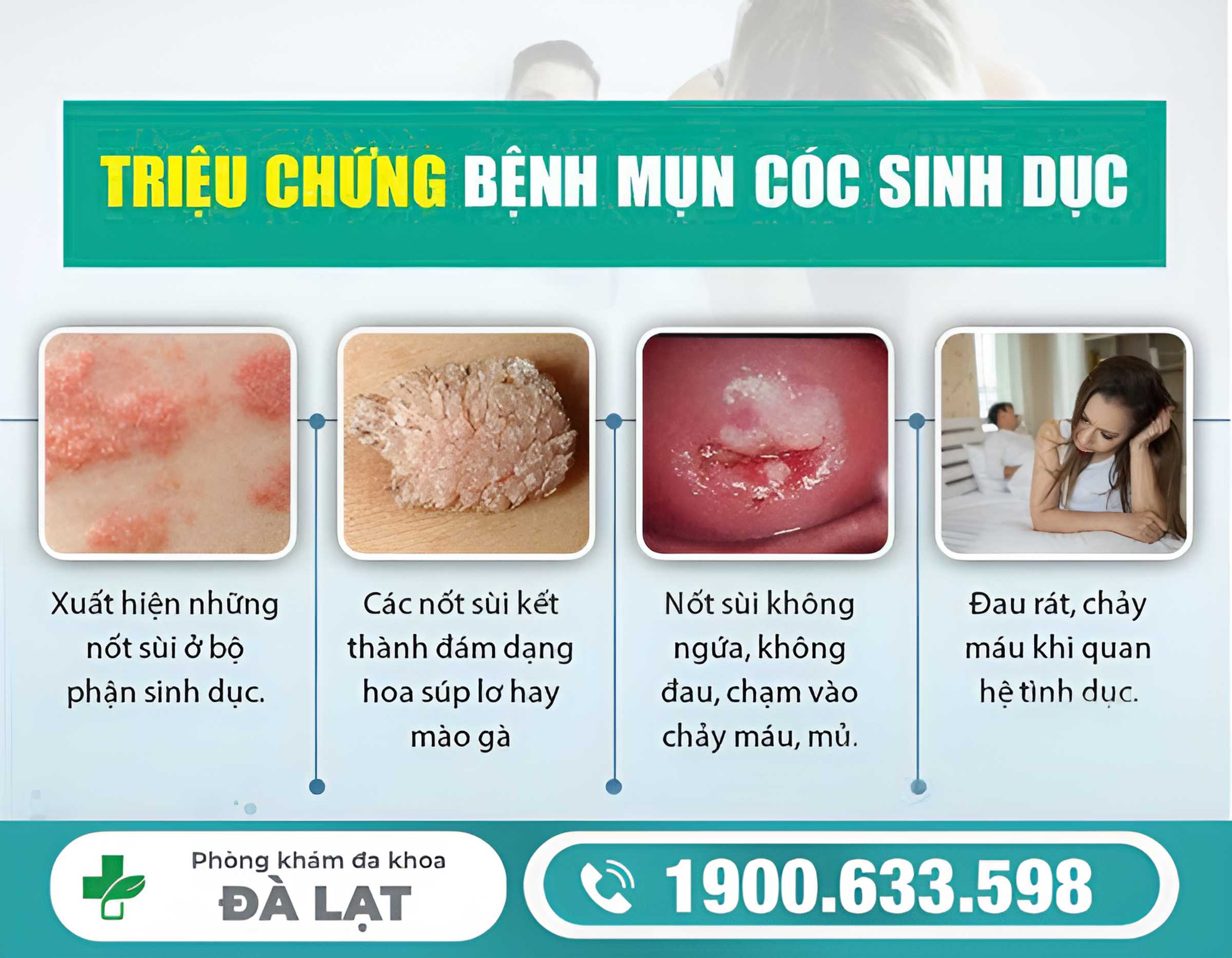 Hình ảnh minh họa